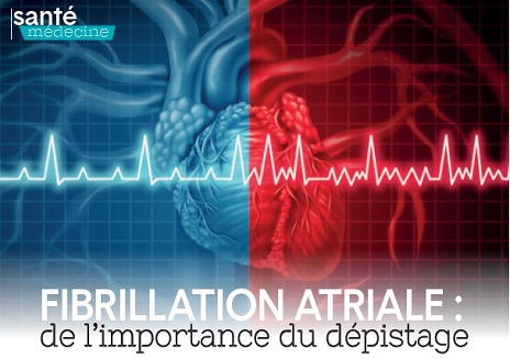 fibrillation-atriale-franck-halimi